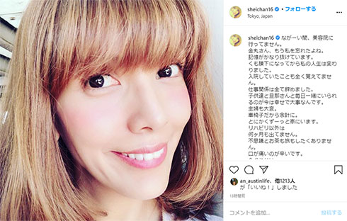 SHEILA くも膜下出血 後遺症