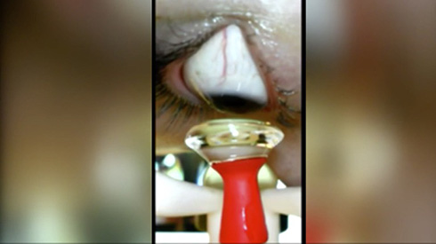 目を開けて「取り外して」と頼めばOK　コンタクトレンズの着け外しをしてくれるロボットが誕生