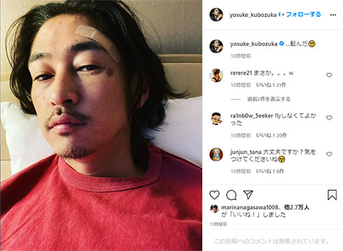 窪塚洋介 怪我 顔