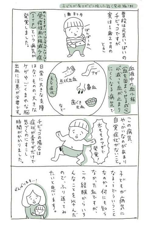 子どもが青アザで入院した話01