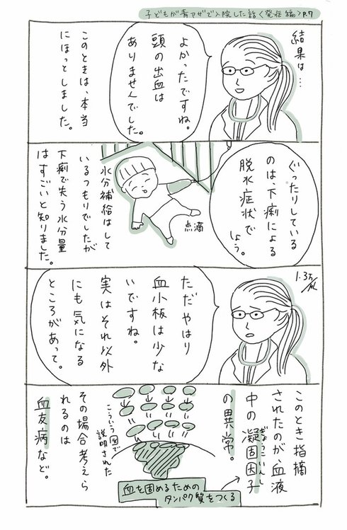 子どもが青アザで入院した話07