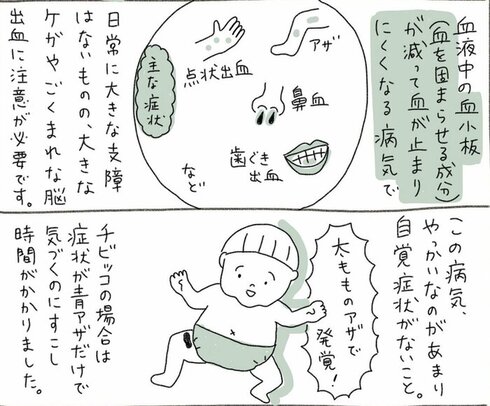 子どもが青アザで入院した話30