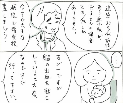 子どもが青アザで入院した話31