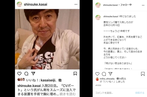 笠井信輔 悪性リンパ腫 現在 治療 ガン