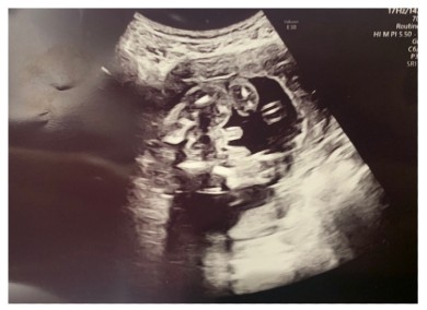 桃 あいのり 結婚 ブログ 夫