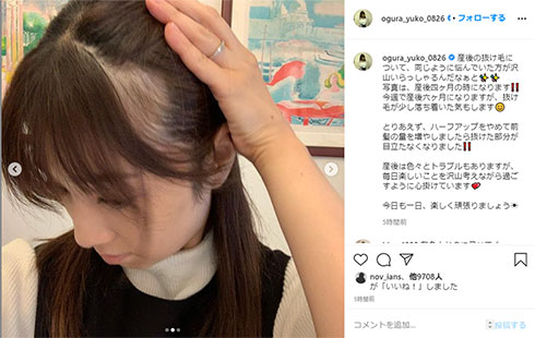小倉優子 産後 抜け毛