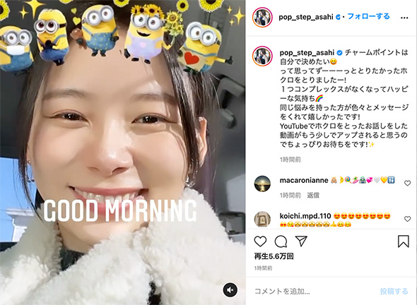 朝日奈央 ホクロ 除去 チャームポイント コンプレックス