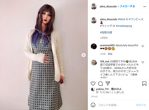 ビジュアル系 バンド DISACODE ボーカル AKIRA アキラ KERA 男装 モデル 結婚 出産