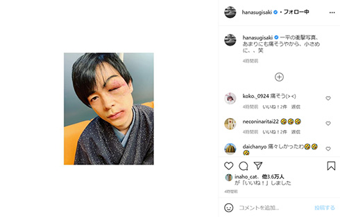 杉咲花 成田凌 おちょやん ボコボコ