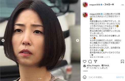 MEGUMI ほうれい線