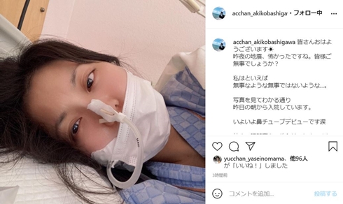 尾崎亜衣 子宮頸がん 腸閉塞 入院 小橋川亜希