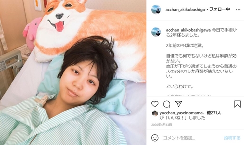 尾崎亜衣 子宮頸がん 腸閉塞 入院 小橋川亜希