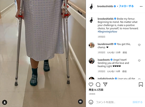 ブルック・シールズ 今の姿 骨折 大腿骨 年齢 プリティ・ベビー 子役 青い珊瑚礁 ブルーラグーン