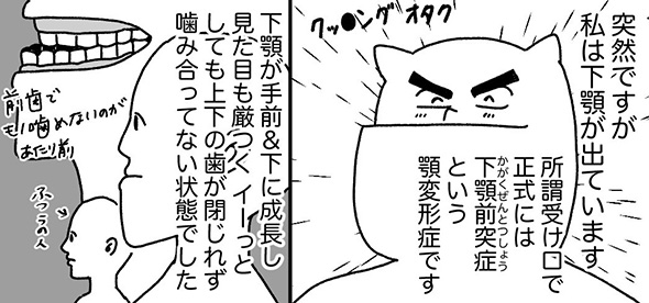 「歯の上で鈴鹿8耐が開催」「厚めのネギが歯の間にめりこむ」　顎変形症の治療過程を描いた実体験漫画が面白くて勉強にもなる