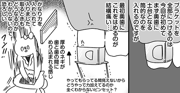 「歯の上で鈴鹿8耐が開催」「厚めのネギが歯の間にめりこむ」　顎変形症の治療過程を描いた実体験漫画が面白くて勉強にもなる