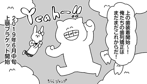 「歯の上で鈴鹿8耐が開催」「厚めのネギが歯の間にめりこむ」　顎変形症の治療過程を描いた実体験漫画が面白くて勉強にもなる