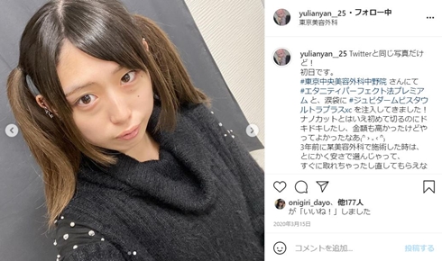 ゆりあんぬ 内海和子 整形 総額 地下アイドル