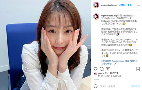 宇垣美里 手術 ICL治療