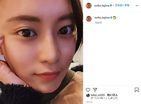 小島瑠璃子 親知らず パンパン 食パンマン 抜歯 同一人物