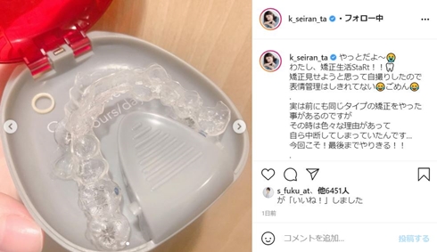 小林星蘭 子役 現在 歯列矯正 インビザライン