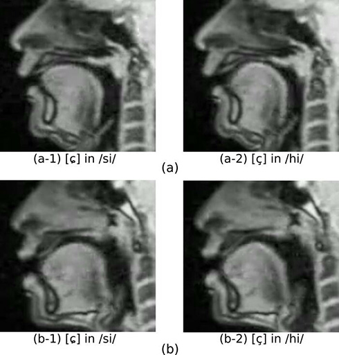 「ヒ」と「シ」の発音を混同するメカニズムが判明　スパコンとMRIを駆使した苦心の末