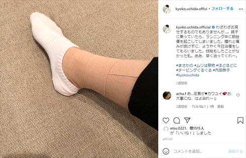 内田恭子 インスタ 足首 ケガ
