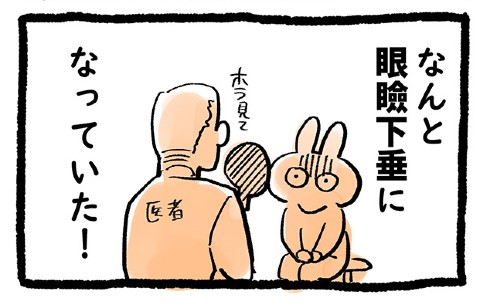 眼瞼下垂 手術 体験談