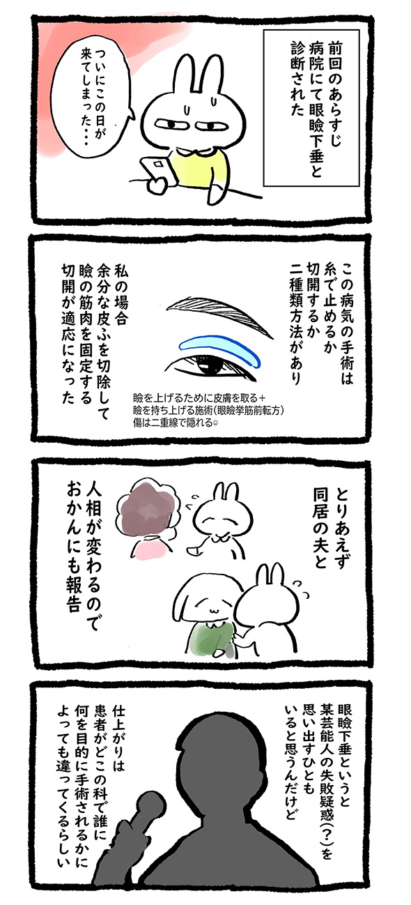 眼瞼下垂 手術 体験談