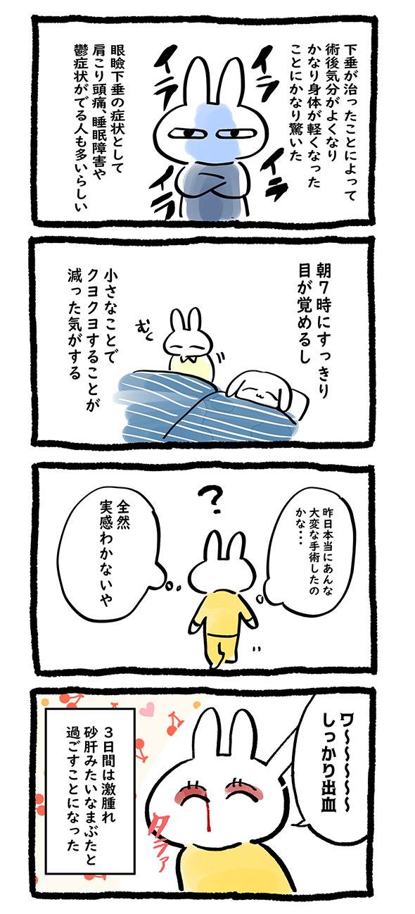 眼瞼下垂 手術 体験談