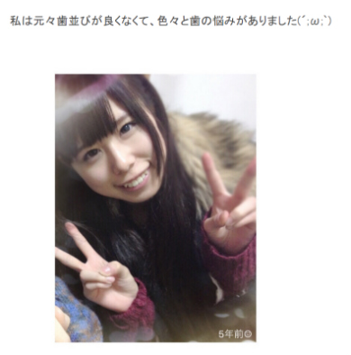 有村藍里 美容整形手術