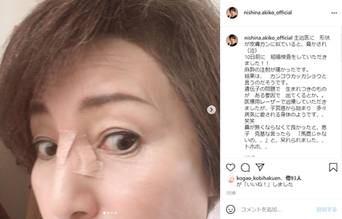 仁科亜季子 皮膚がん 子宮頸がん 胃がん 大腸がん GIST