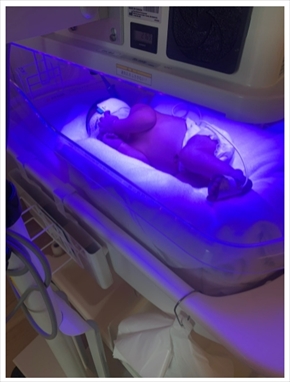 倉持由香 ふ〜ど 息子 出産 尻職人 ゲーマー夫婦 インスタ ブログ 新生児黄疸 光線療法