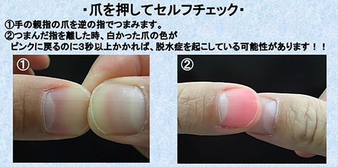 指をつまむだけの熱中症チェック　厚労省のセルフ確認が簡単すぎて活用したい