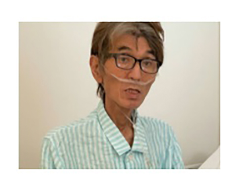 大島康徳 ステージ4 大腸がん 転移