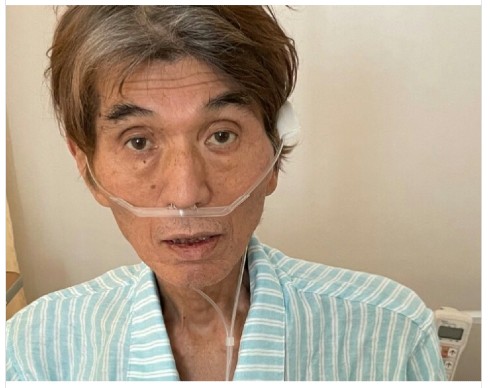 大島康徳 野球 がん 治療 入院 ブログ