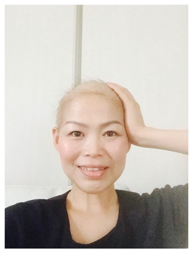 だいたひかる　乳がん 抗がん剤 ハゲ 髪