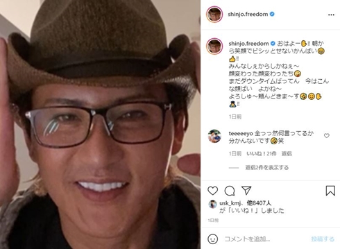新庄剛志 現在 顔 整形 人志松本の酒のツマミになる話