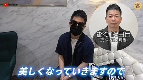 宮迫博之 雨上がり決死隊 クマ ほうれい線 美容整形手術