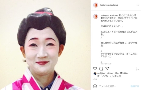 虻川美穂子 アトピー 肌荒れ ヒリヒリ 顔