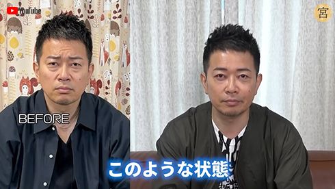 雨上がり決死隊 宮迫博之 クマ ほうれい線 美容整形