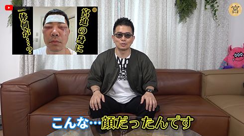 雨上がり決死隊 宮迫博之 クマ ほうれい線 美容整形