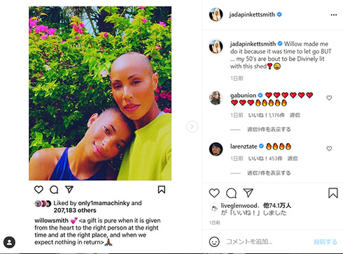 ウィル・スミス ジェイダ・ピンケット・スミス 坊主 脱毛症