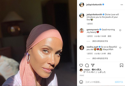 ウィル・スミス ジェイダ・ピンケット・スミス 坊主 脱毛症