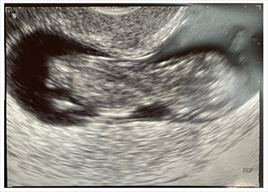 だいたひかる 妊娠 不妊治療 妊婦健診 エコー写真 ブログ