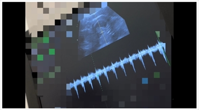 だいたひかる 妊娠 不妊治療 妊婦健診 エコー写真 ブログ