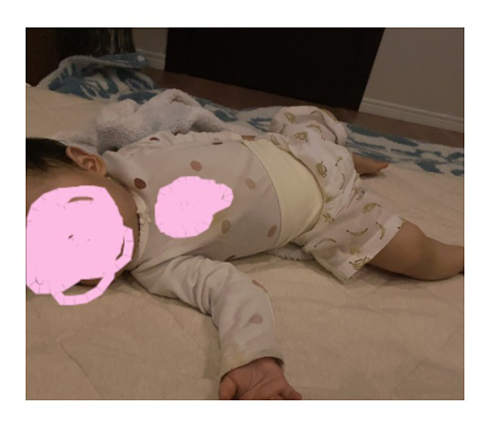 光上せあら SND RSウイルス 胃腸炎