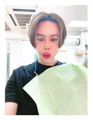 アレン 整形男子 差し歯