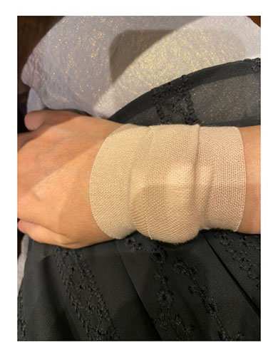 堀ちえみ 口腔がん 良性腫瘍 食道がん