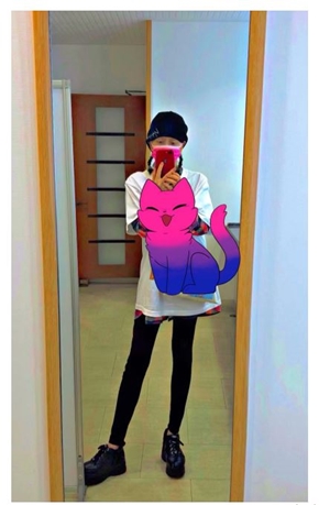 広田レオナ 肺がん 肺気胸