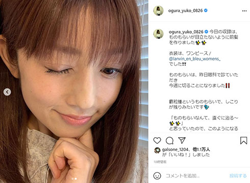 小倉優子 ものもらい 手術